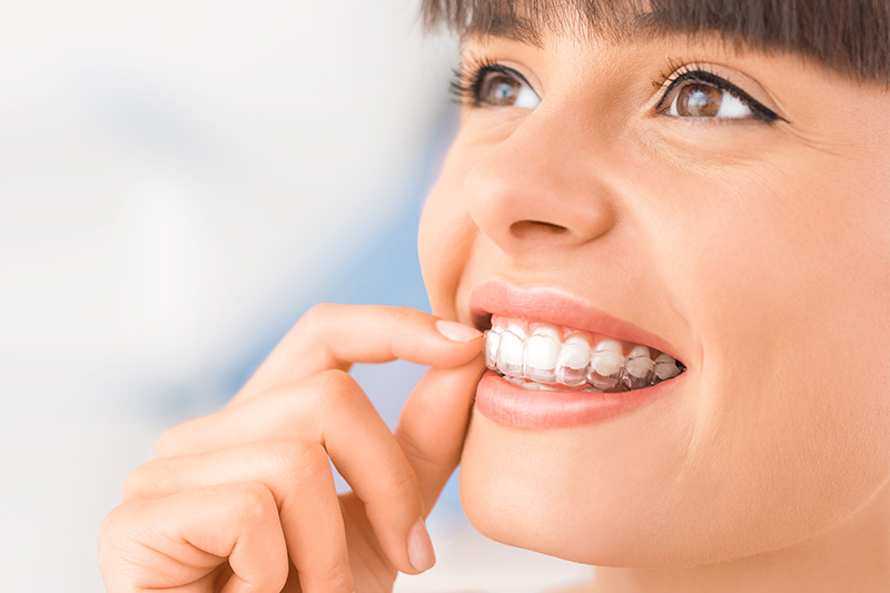 Dental Treatments in Sarasota
